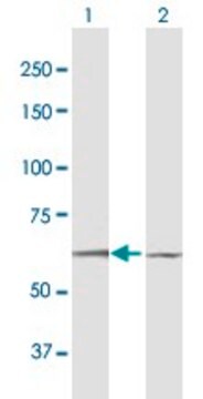 Anti-DYRK1B antibody produced in mouse purified immunoglobulin, buffered aqueous solution