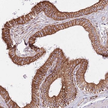 Anti-MOGAT1 antibody produced in rabbit Prestige Antibodies&#174; Powered by Atlas Antibodies, affinity isolated antibody, buffered aqueous glycerol solution