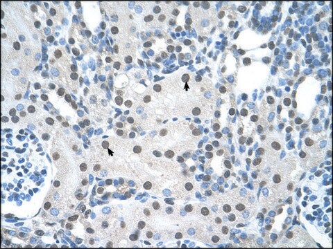 Anti-YWHAQ antibody produced in rabbit affinity isolated antibody