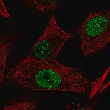 Anti-MGAT5B antibody produced in rabbit Prestige Antibodies&#174; Powered by Atlas Antibodies, affinity isolated antibody