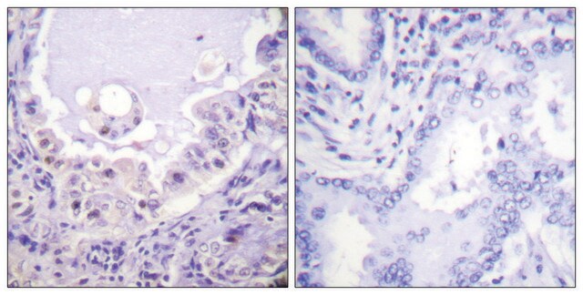Anti-C-RAF, C-Terminal antibody produced in rabbit affinity isolated antibody