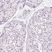 Anti-SSTR4 antibody produced in rabbit Prestige Antibodies&#174; Powered by Atlas Antibodies, affinity isolated antibody, buffered aqueous glycerol solution