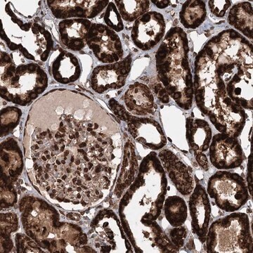 Anti-BCKDHA antibody produced in rabbit Prestige Antibodies&#174; Powered by Atlas Antibodies, affinity isolated antibody, buffered aqueous glycerol solution