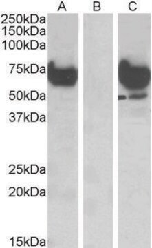 Anti-EPM2AIP1 antibody produced in goat affinity isolated antibody, buffered aqueous solution