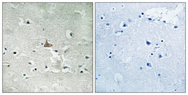 Anti-phospho-Trk B (pTyr706/Tyr707) antibody produced in rabbit affinity isolated antibody