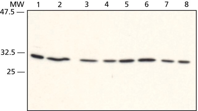 Anti-RACK1 (C-terminal) antibody produced in rabbit ~1&#160;mg/mL, affinity isolated antibody, buffered aqueous solution, immunoprecipitation: 5 &#956;g