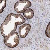 Anti-PYGB antibody produced in rabbit Prestige Antibodies&#174; Powered by Atlas Antibodies, affinity isolated antibody, buffered aqueous glycerol solution