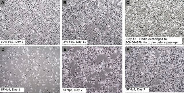 LX-2 Human Hepatic Stellate Serum-Free Media