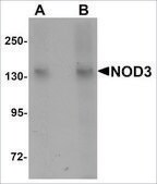 Anti-NOD3 antibody produced in rabbit affinity isolated antibody, buffered aqueous solution
