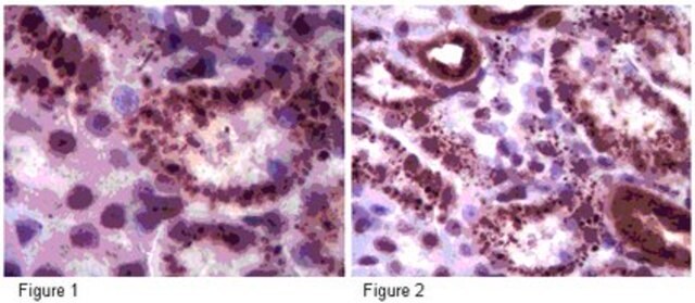 Anti-Sirt5 Antibody from rabbit, purified by affinity chromatography