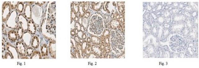 Anti-PRDM16 Antibody from rabbit, purified by affinity chromatography