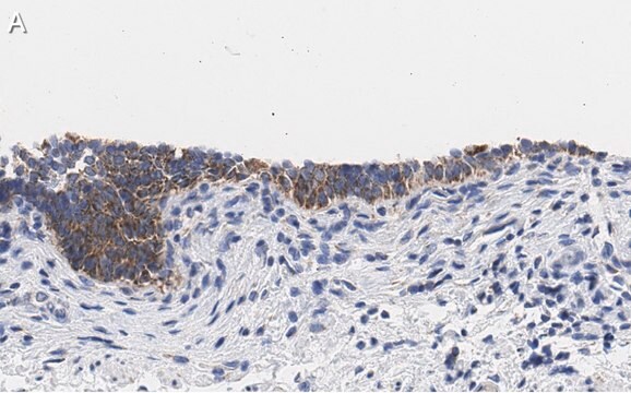 Anti-TMEM261 Antibody, clone 2C22 ZooMAb&#174; Rabbit Monoclonal recombinant, expressed in HEK 293 cells