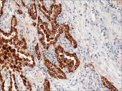 Anti-SP-B (Surfactant protein B) antibody, Rabbit monoclonal recombinant, expressed in HEK 293 cells, clone RM370, purified immunoglobulin