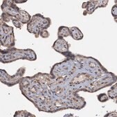 Anti-MGLL antibody produced in rabbit Prestige Antibodies&#174; Powered by Atlas Antibodies, affinity isolated antibody, buffered aqueous glycerol solution