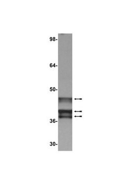 Anti-E1A (Ad2/Ad5) Antibody, clone M73 clone M73, Upstate&#174;, from mouse