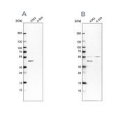 Anti-GLUL antibody produced in rabbit Ab1, Prestige Antibodies&#174; Powered by Atlas Antibodies, affinity isolated antibody, buffered aqueous glycerol solution