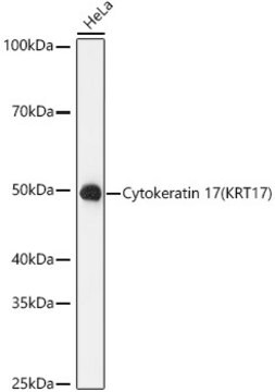Anti-Cytokeratin 17 (KRT17) Antibody, clone 9O6X9, Rabbit Monoclonal