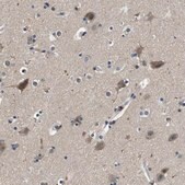 Anti-KCNQ5 antibody produced in rabbit Prestige Antibodies&#174; Powered by Atlas Antibodies, affinity isolated antibody, buffered aqueous glycerol solution