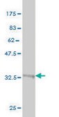 Monoclonal Anti-GGT1 antibody produced in mouse clone 1F9, purified immunoglobulin, buffered aqueous solution
