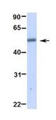 Anti-TRIM21 antibody produced in rabbit affinity isolated antibody