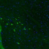 Monoclonal Anti-DDC antibody produced in mouse Prestige Antibodies&#174; Powered by Atlas Antibodies, clone CL2962, purified immunoglobulin, buffered aqueous glycerol solution