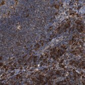 Anti-PTPN1 antibody produced in rabbit Prestige Antibodies&#174; Powered by Atlas Antibodies, affinity isolated antibody, buffered aqueous glycerol solution