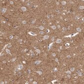 Anti-KLHL7 antibody produced in rabbit Prestige Antibodies&#174; Powered by Atlas Antibodies, affinity isolated antibody, buffered aqueous glycerol solution, ab1