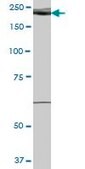 Anti-WHSC1L1 antibody produced in mouse purified immunoglobulin, buffered aqueous solution