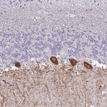 Anti-GALNT16 antibody produced in rabbit Prestige Antibodies&#174; Powered by Atlas Antibodies, affinity isolated antibody, buffered aqueous glycerol solution