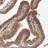 Anti-TYK2 antibody produced in rabbit Prestige Antibodies&#174; Powered by Atlas Antibodies, affinity isolated antibody, buffered aqueous glycerol solution