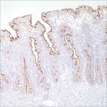 Villin (CWWB1) Mouse Monoclonal Antibody