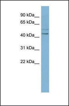 Anti-SLC46A1 antibody produced in rabbit affinity isolated antibody