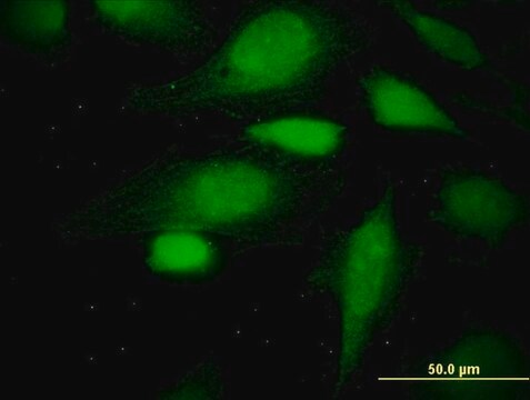 Monoclonal Anti-ATE1 antibody produced in mouse clone 2B6, purified immunoglobulin, buffered aqueous solution