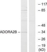 Anti-ADORA2B antibody produced in rabbit affinity isolated antibody