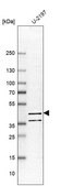 Anti-PDE7B antibody produced in rabbit Prestige Antibodies&#174; Powered by Atlas Antibodies, affinity isolated antibody, buffered aqueous glycerol solution