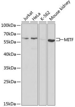 Anti-MITF antibody produced in rabbit