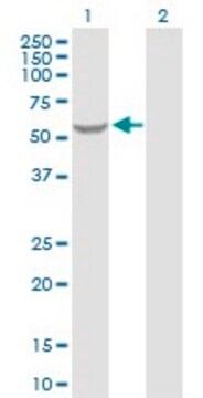 Anti-GK2 antibody produced in rabbit purified immunoglobulin, buffered aqueous solution