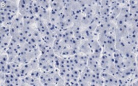 Anti-ROR&#947; Antibody, clone 1D13 ZooMAb&#174; Rabbit Monoclonal recombinant, expressed in HEK 293 cells