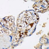 Anti-Fibrinogen alpha chain (FGA) antibody produced in rabbit