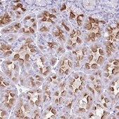 Anti-ATP4B antibody produced in rabbit Prestige Antibodies&#174; Powered by Atlas Antibodies, affinity isolated antibody, buffered aqueous glycerol solution