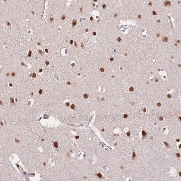 Anti-RFK antibody produced in rabbit Prestige Antibodies&#174; Powered by Atlas Antibodies, affinity isolated antibody, buffered aqueous glycerol solution