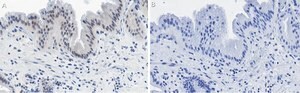 Anti-Nrf2 Antibody, clone 5B20 ZooMAb&#174; Rabbit Monoclonal recombinant, expressed in HEK 293 cells