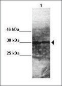 Anti-SRD5A2, (N-terminal) antibody produced in rabbit affinity isolated antibody