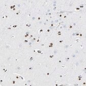 Anti-NFIA antibody produced in rabbit Prestige Antibodies&#174; Powered by Atlas Antibodies, affinity isolated antibody, buffered aqueous glycerol solution