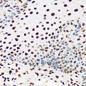 Anti-UAP56/DDX39B antibody produced in rabbit