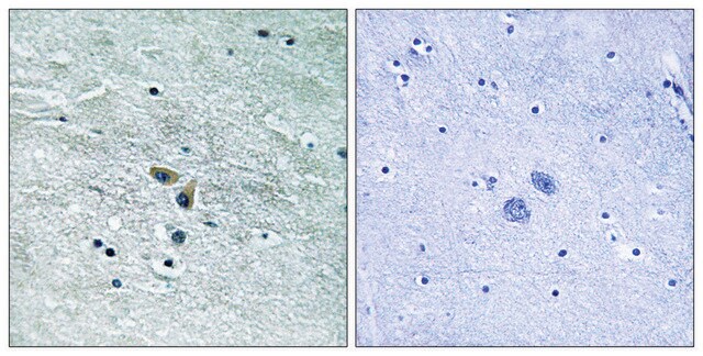 Anti-MAP3K8 antibody produced in rabbit affinity isolated antibody