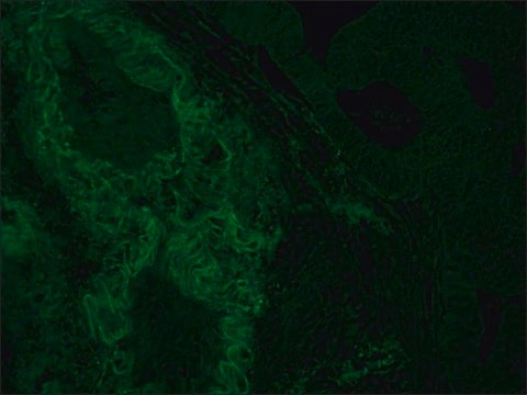 Monoclonal Anti-HLA Class I Antigen&#8722;FITC antibody produced in mouse clone W6/32, purified immunoglobulin, buffered aqueous solution