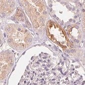 Anti-TREH antibody produced in rabbit Prestige Antibodies&#174; Powered by Atlas Antibodies, affinity isolated antibody, buffered aqueous glycerol solution