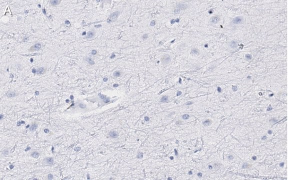 Anti-Neurogranin Antibody, clone 1D4 , ZooMAb&#174; Rabbit Monoclonal recombinant, expressed in HEK 293 cells