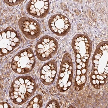 Anti-MIF4GD antibody produced in rabbit Prestige Antibodies&#174; Powered by Atlas Antibodies, affinity isolated antibody, buffered aqueous glycerol solution